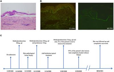 Successful Treatment of Bullous Pemphigoid Lesions by Berberine Stamp Therapy: A Case Report and Literature Review